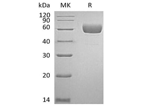 Recombinant Human Serpin A7/TBG (C-6His) - ABMIUM