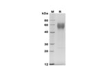SDS-PAGE analysis of Human CD28 proteins, 2 μg/lane of Recombinant Human CD28 proteins was resolved with SDS-PAGE under reducing conditions, showing bands at 55-70 kDa.