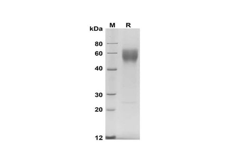 SDS-PAGE analysis of Human CD28 proteins, 2 μg/lane of Recombinant Human CD28 proteins was resolved with SDS-PAGE under reducing conditions, showing bands at 55-70 kDa.