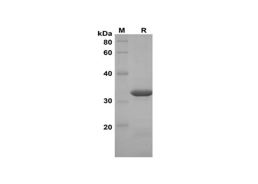 SDS-PAGE analysis of Mouse Galectin-7 proteins, 2 μg/lane of Recombinant Mouse Galectin-7 proteins was resolved with SDS-PAGE under reducing conditions, showing bands at 33 kDa.