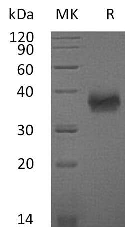 Recombinant Mouse SLAMF5/CD84 Protein (His Tag) - ABMIUM