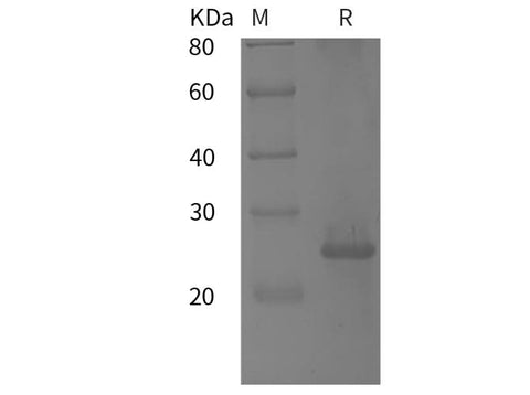 SDS-PAGE analysis of Human IL-17F proteins, 2 μg/lane of Recombinant Human IL-17F proteins was resolved with SDS-PAGE under reducing conditions, showing bands at 16 kDa.