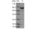 Recombinant Human NCF2/P67phox Protein - ABMIUM