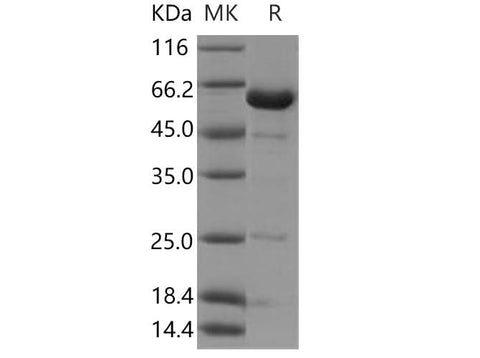 Recombinant Human NCF2/P67phox Protein - ABMIUM