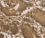 Anti-Human/Mouse KDM5B Antibody - ABMIUM
