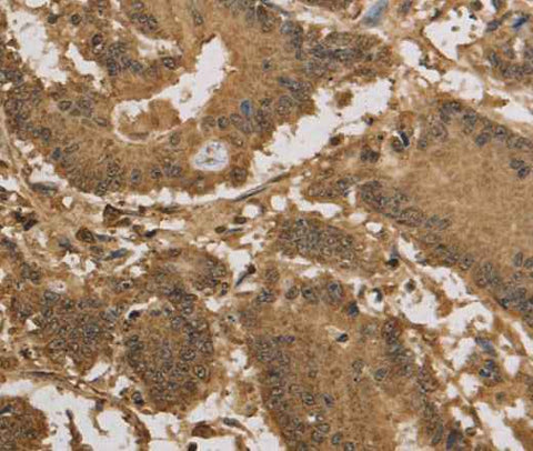 Anti-Human/Mouse KDM5B Antibody