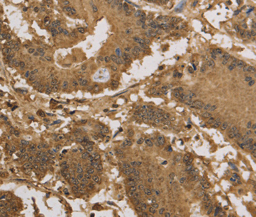 Anti-Human/Mouse KDM5B Antibody - ABMIUM