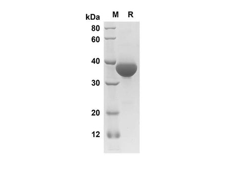 SDS-PAGE analysis of Human EGF proteins, 2 μg/lane of Recombinant Human EGF proteins was resolved with SDS-PAGE under reducing conditions, showing bands at 30.7 kDa.