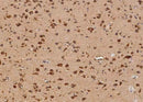 Anti-Human AIMP1 Antibody [A1035] - ABMIUM