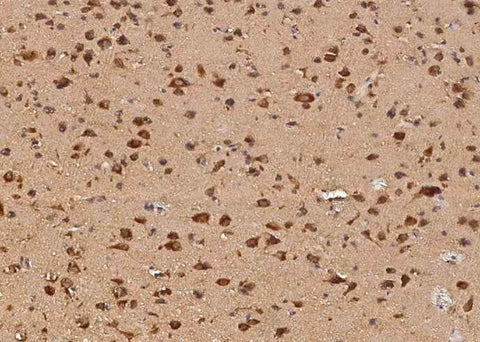Anti-Human AIMP1 Antibody [A1035] - ABMIUM
