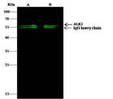 Anti-Human ACVRL1 Antibody [A1288] - ABMIUM