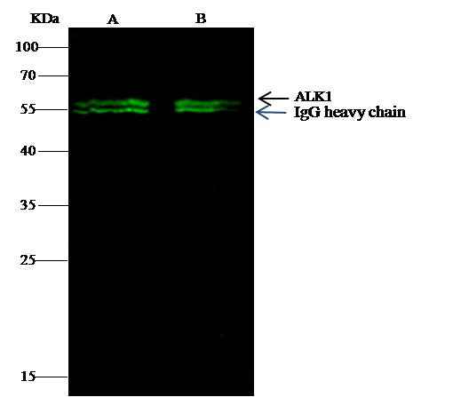 Anti-Human ACVRL1 Antibody [A1288] - ABMIUM