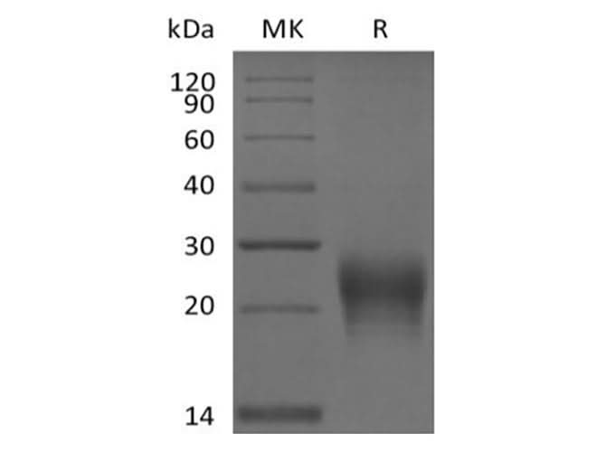 Recombinant Human Fas Ligand / TNFSF6 (N-6His) - ABMIUM