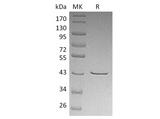 Recombinant Human CHI3L2/YKL-39 Protein (His Tag) - ABMIUM