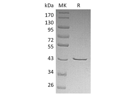 Recombinant Human CHI3L2/YKL-39 Protein (His Tag) - ABMIUM