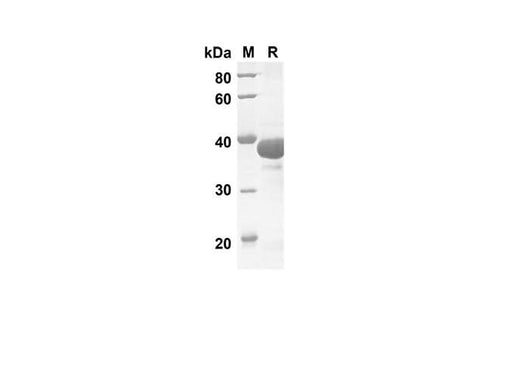 SDS-PAGE analysis of Human IL17D proteins, 2 μg/lane of Recombinant Human IL17D proteins was resolved with SDS-PAGE under reducing conditions, showing bands at 33.4 kDa.