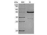 Recombinant Human UBE2D1 Protein (GST Tag) - ABMIUM