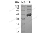 Recombinant Human MECR Protein (His Tag) - ABMIUM