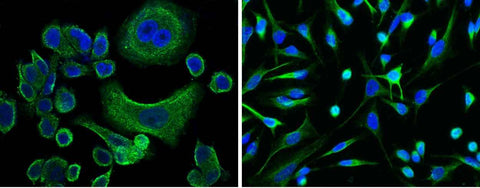 Anti-Human AFP Antibody [A862] - ABMIUM