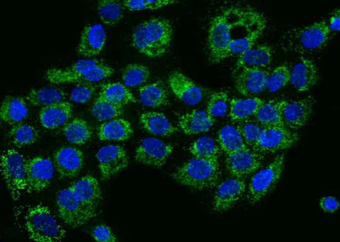 Anti-Human HIGD1A Antibody - ABMIUM