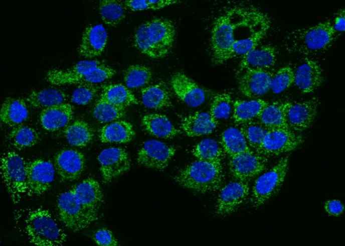Anti-Human HIGD1A Antibody - ABMIUM