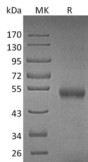 Recombinant Mouse Osteoprotegerin/TNFRSF11B Protein (His Tag) - ABMIUM