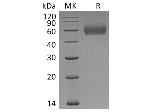 Recombinant Human IL1R2/CD121b Protein (His Tag) - ABMIUM