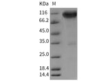Recombinant Rat TrkA/NTRK1 Protein (Fc Tag) - ABMIUM