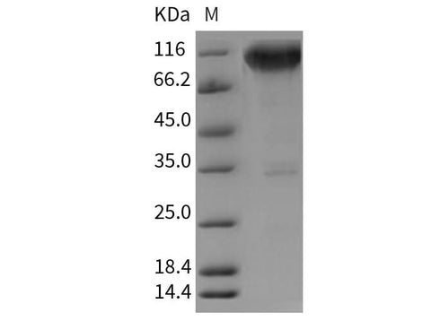 Recombinant Rat TrkA/NTRK1 Protein (Fc Tag) - ABMIUM