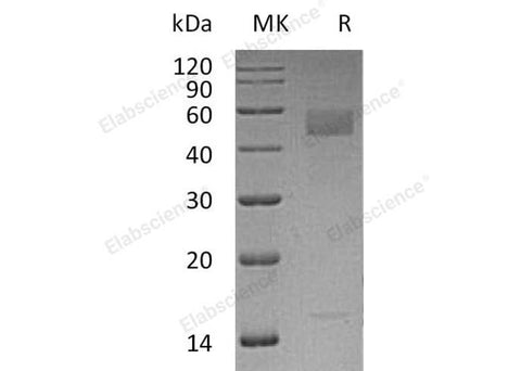 Recombinant Human Inhibin β C Chain/INHBC Protein (aa 19-352, His Tag) - ABMIUM