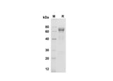 SDS-PAGE analysis of Mouse Cathepsin B proteins , 2 μg/lane of Recombinant Mouse Cathepsin B proteins was resolved with SDS-PAGE under reducing conditions , showing bands at 70 kDa.