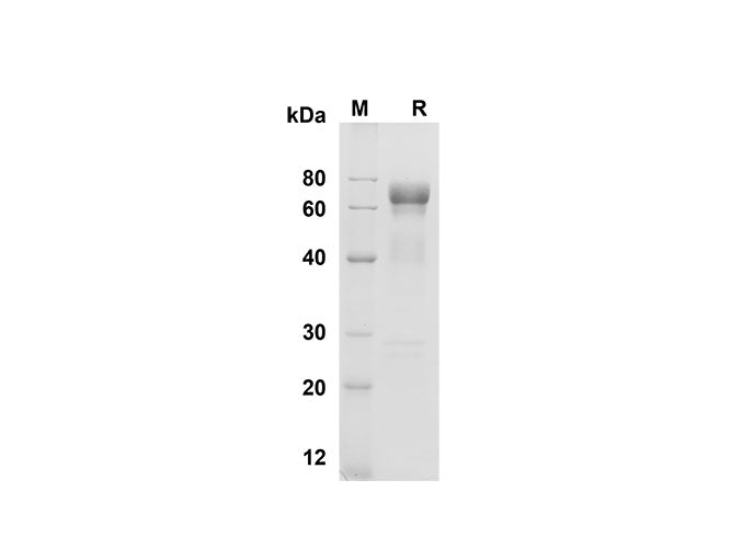 SDS-PAGE analysis of Mouse Cathepsin B proteins , 2 μg/lane of Recombinant Mouse Cathepsin B proteins was resolved with SDS-PAGE under reducing conditions , showing bands at 70 kDa.