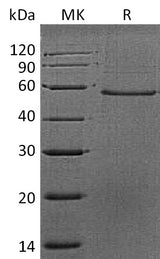 Recombinant Mouse Dermatopontin/DPT Protein (Fc Tag) - ABMIUM