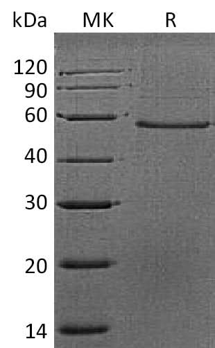 Recombinant Mouse Dermatopontin/DPT Protein (Fc Tag) - ABMIUM