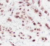 Anti-Human FOXA1 Antibody [A224]