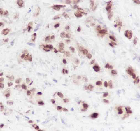 Anti-Human FOXA1 Antibody [A224] - ABMIUM