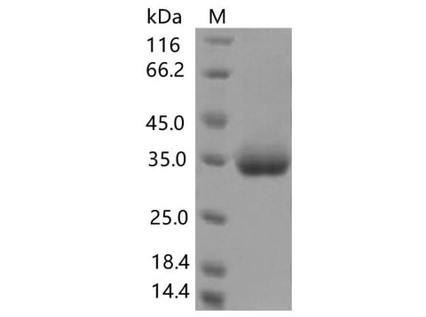 Recombinant SARS-CoV-2 Spike RBD(K378R)(His Tag) - ABMIUM