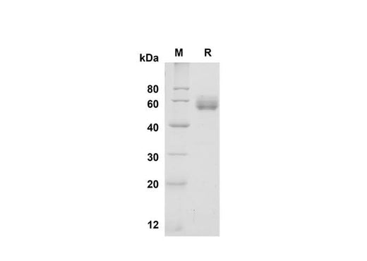 SDS-PAGE analysis of Mouse Folate Binding protein/FBP proteins, 2 μg/lane of Recombinant Mouse Folate Binding protein/FBP proteins was resolved with SDS-PAGE under reducing conditions, showing bands at 47.8 kDa.