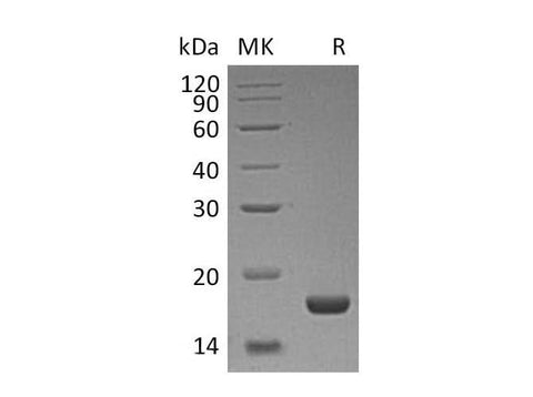 Recombinant Human PLA2G1B/PLA2 Protein (His Tag) - ABMIUM