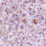Anti-Human Thyroglobulin Antibody [A378]