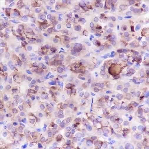 Anti-Human Thyroglobulin Antibody [A378] - ABMIUM