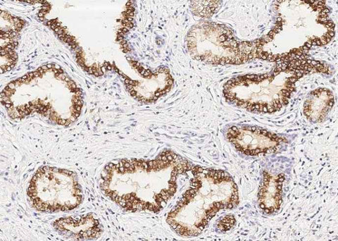 Anti-Human ENTPD5 Antibody [A965] - ABMIUM