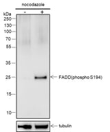 Anti-Human Phospho-FADD (S194) Antibody [A808] - ABMIUM