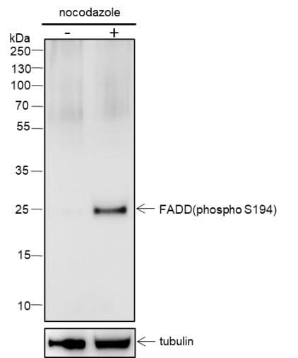 Anti-Human Phospho-FADD (S194) Antibody [A808] - ABMIUM