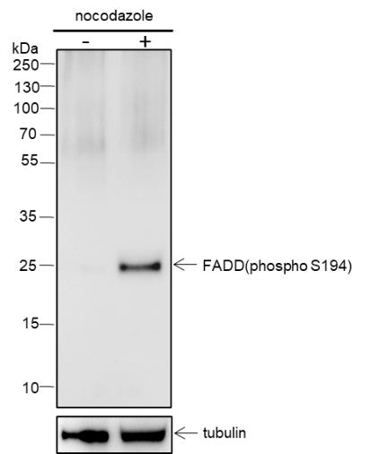 Anti-Human Phospho-FADD (S194) Antibody [A808] - ABMIUM