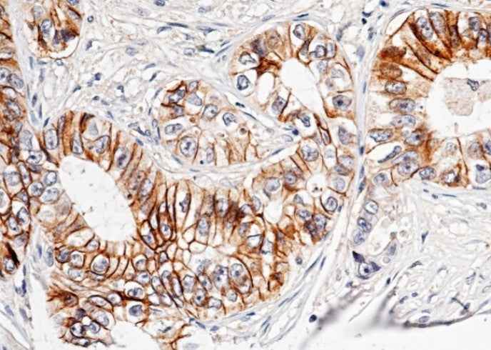 Anti-Human CDH17 Antibody [B150] - ABMIUM