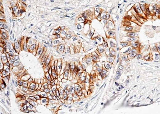 Anti-Human CDH17 Antibody [B150] - ABMIUM