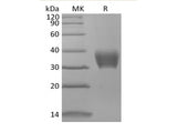 Recombinant Mouse BTNL4 (C-6His) - ABMIUM