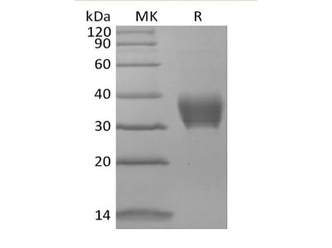 Recombinant Mouse BTNL4 (C-6His) - ABMIUM