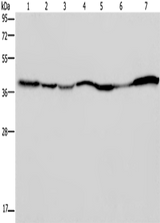 Anti-Human/Mouse/Rat GOT2 Antibody - ABMIUM